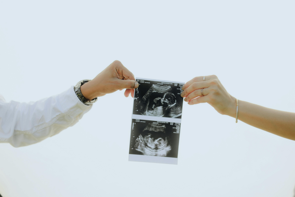 Photo d'une échographie tenue par la main d'une future maman et d'un futur papa